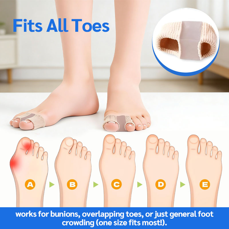 🦶✨ Tåseparator og bunionkorrigerer – smertefri lindring av hallux valgus og overlappende tær for kvinner og menn! ✨👟