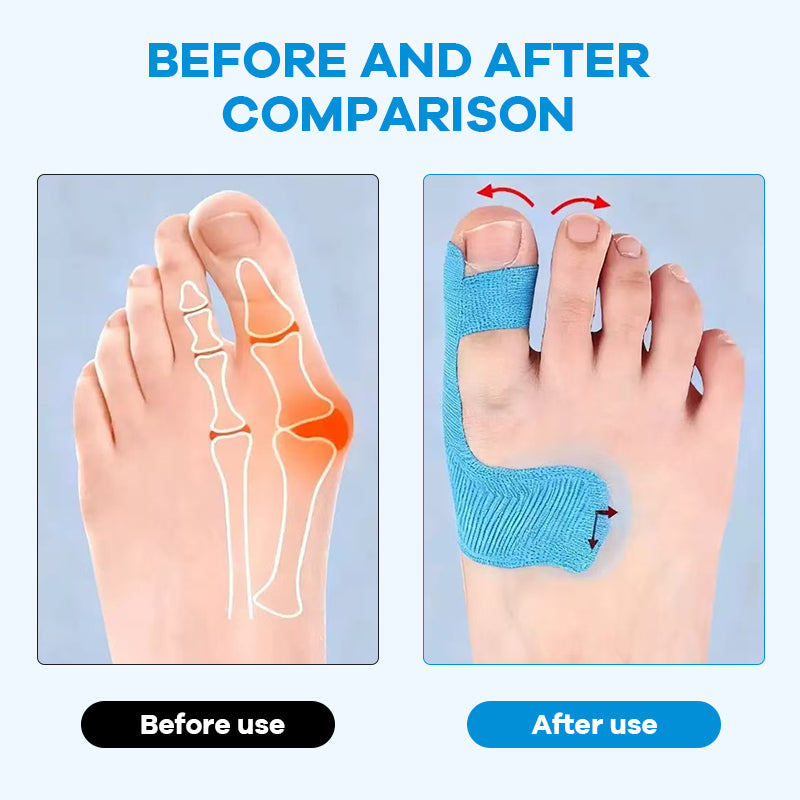 Forhåndskuttet kinesiologitape for hallux valgu