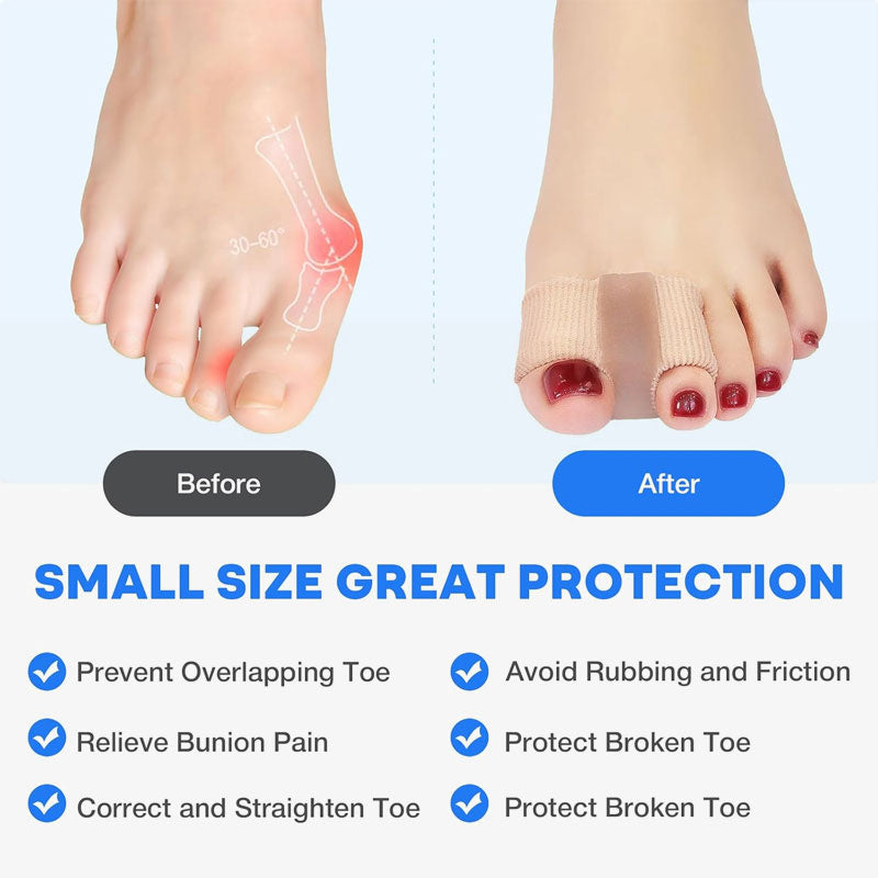 🦶✨ Tåseparator og bunionkorrigerer – smertefri lindring av hallux valgus og overlappende tær for kvinner og menn! ✨👟